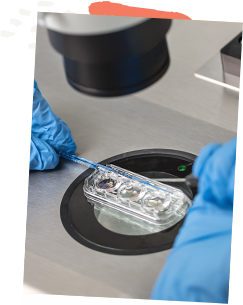 Testing follicle stimulating hormone